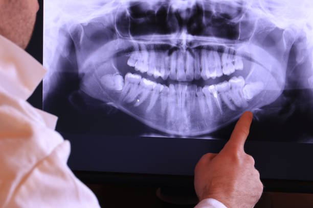 Best Pediatric Emergency Dentist in North Logan, UT