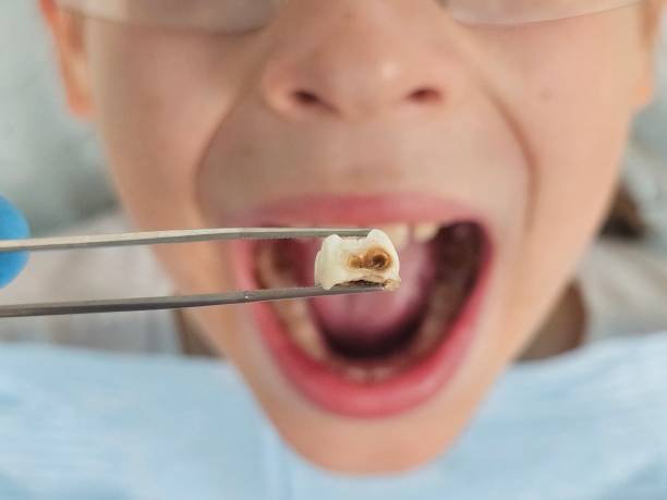 Best Walk-In Emergency Dentist in North Logan, UT