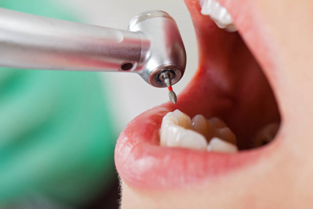 Best Emergency Treatment for Toothache in North Logan, UT